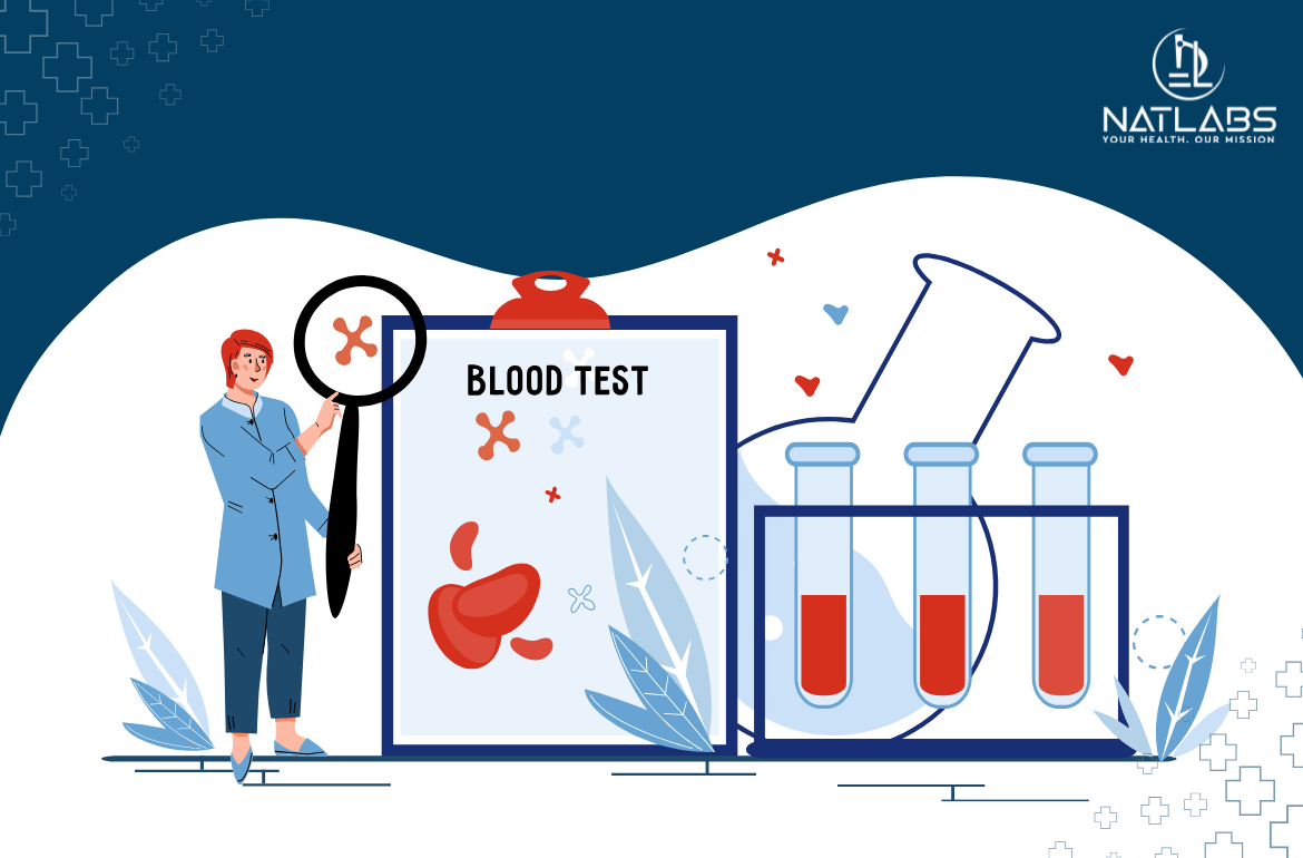 How to Prepare for Your Next Diagnostic Test: Tips for Accurate Results